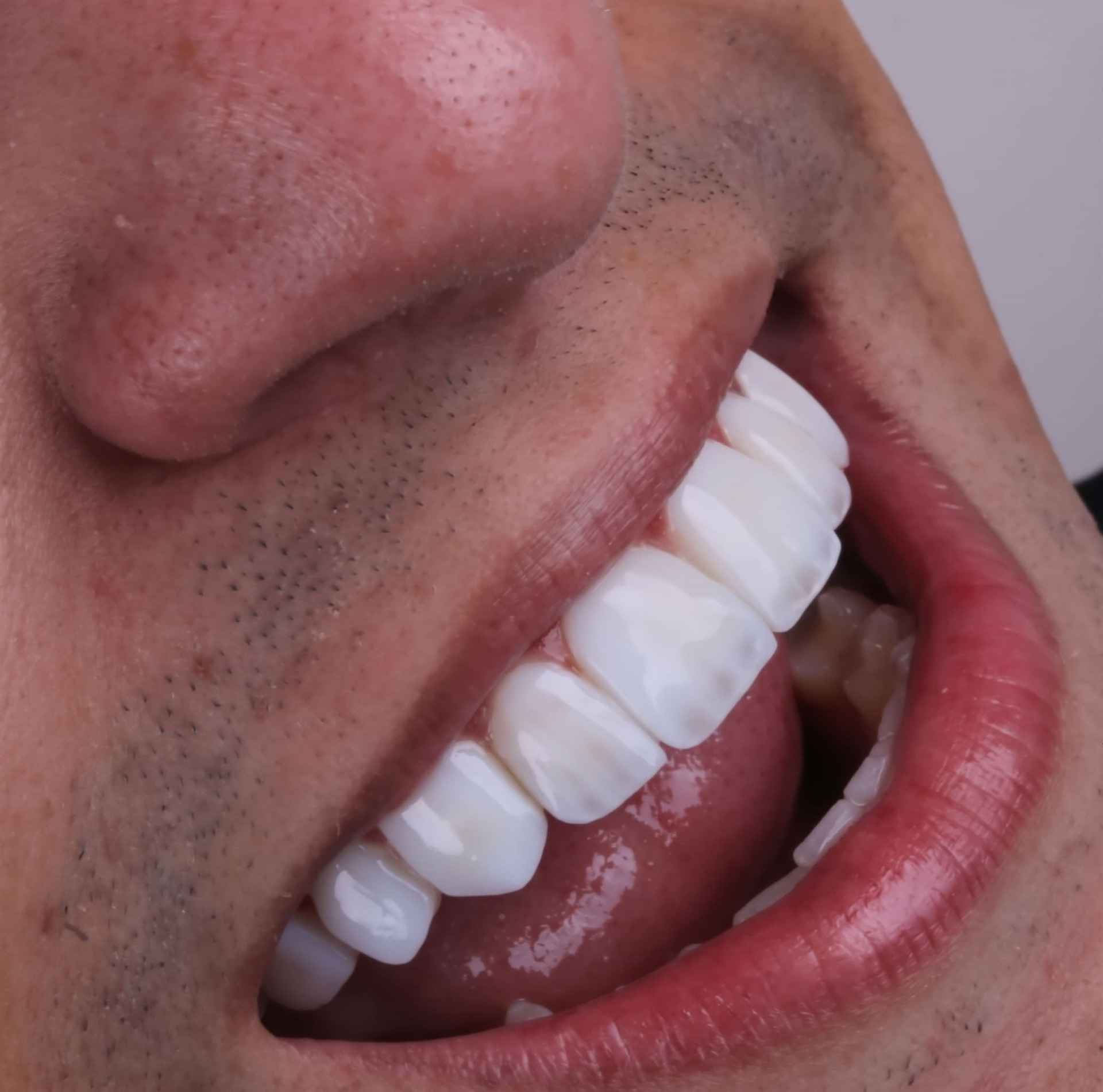 Atendimento odontológico na Odontologia Ramiro