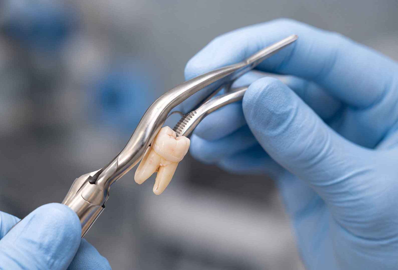 Cirurgia oral menor e procedimentos cirúrgicos odontológicos