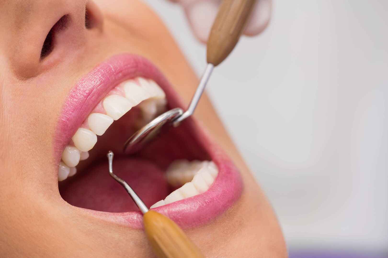 Dentística restauradora e restauração de dentes