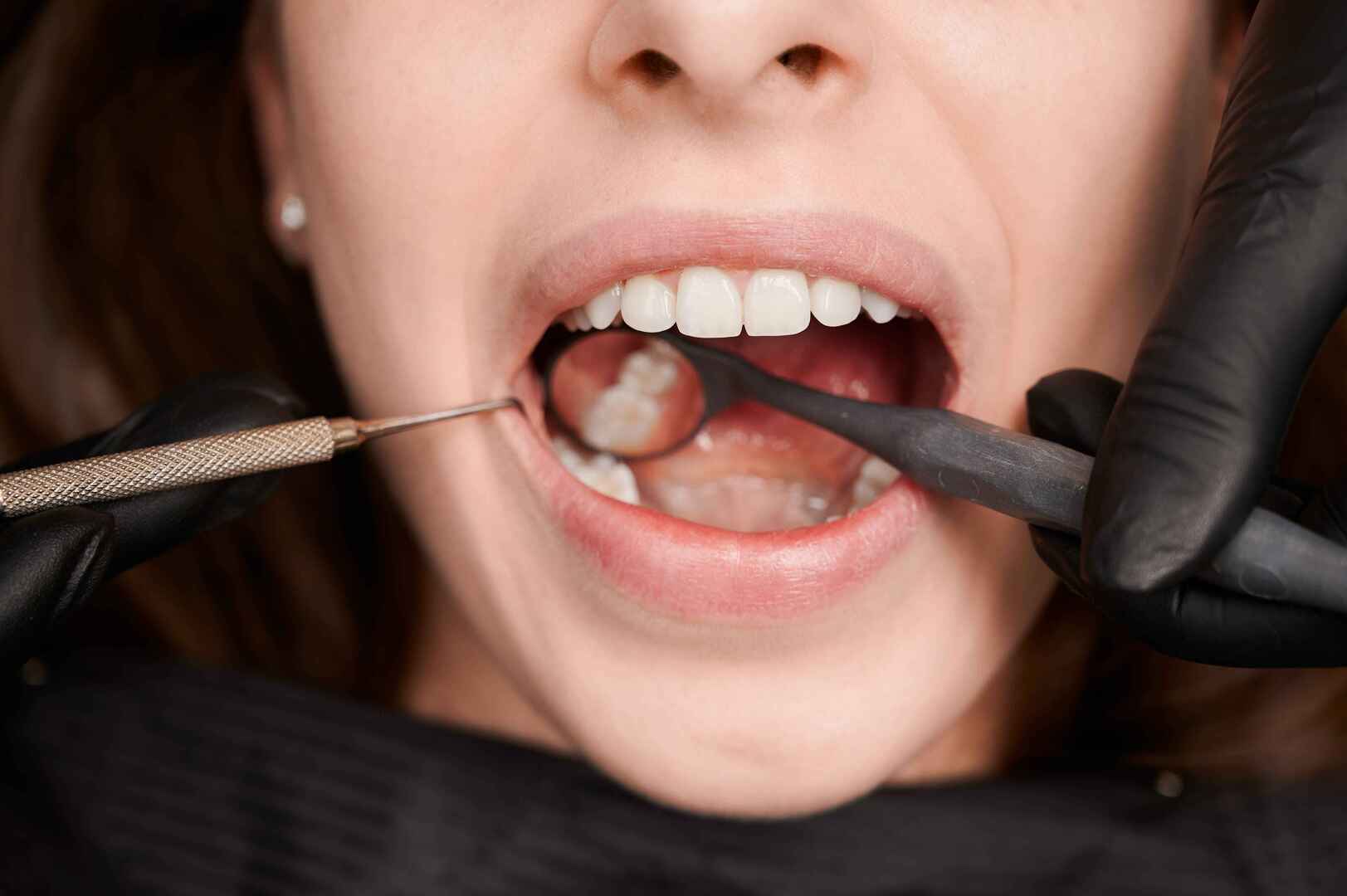 Endodontia e tratamento de canal dentário