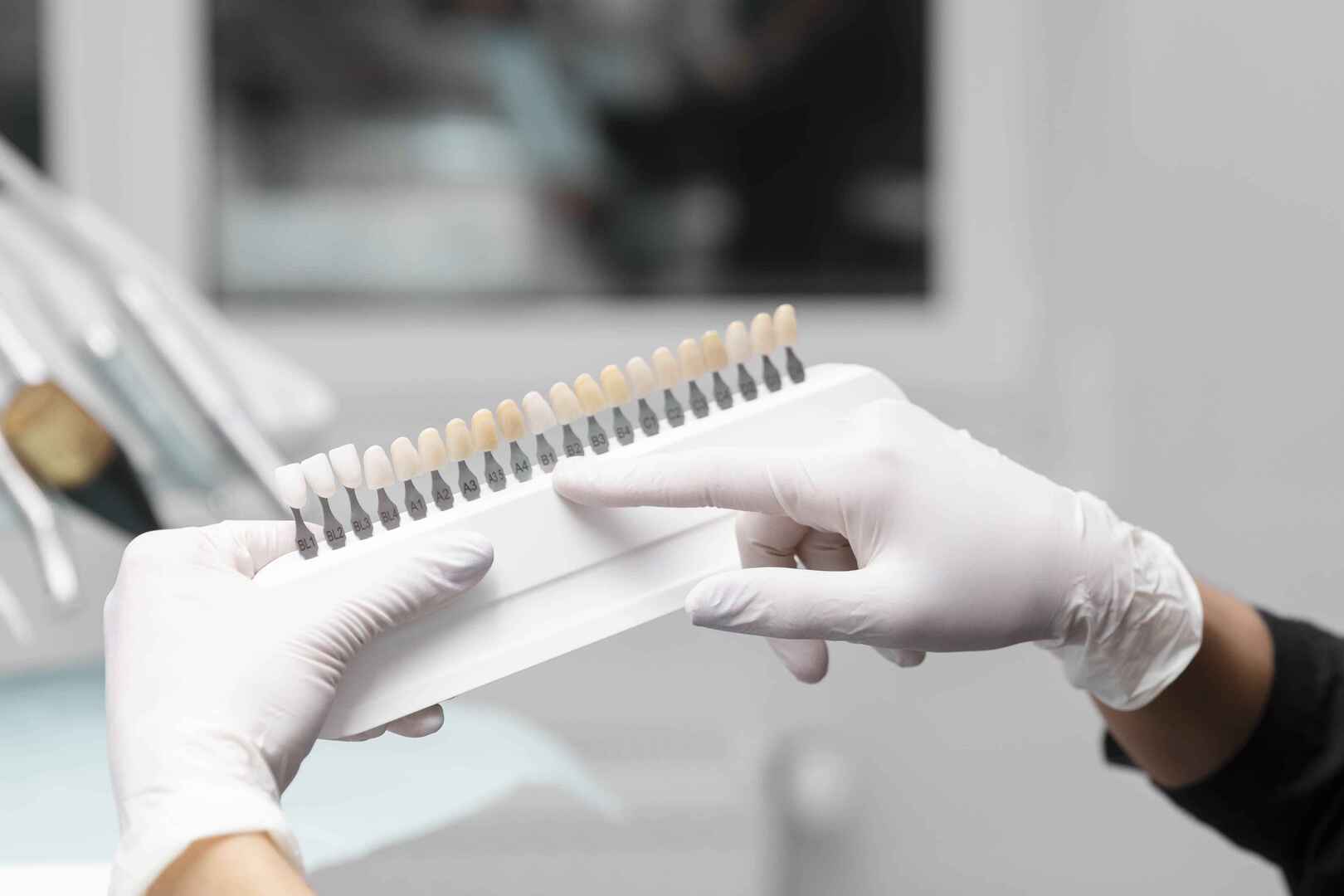 Estética odontológica para harmonização do sorriso