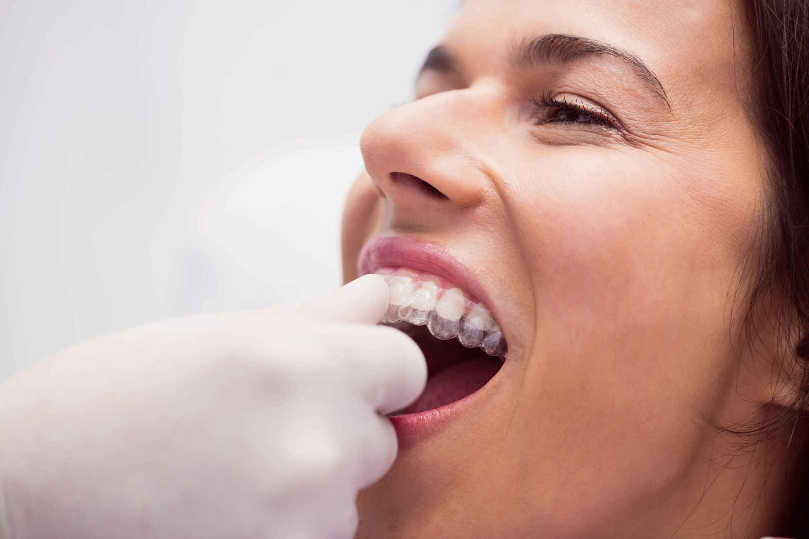 Ortodontia com aparelhos ortodônticos e alinhadores dentários